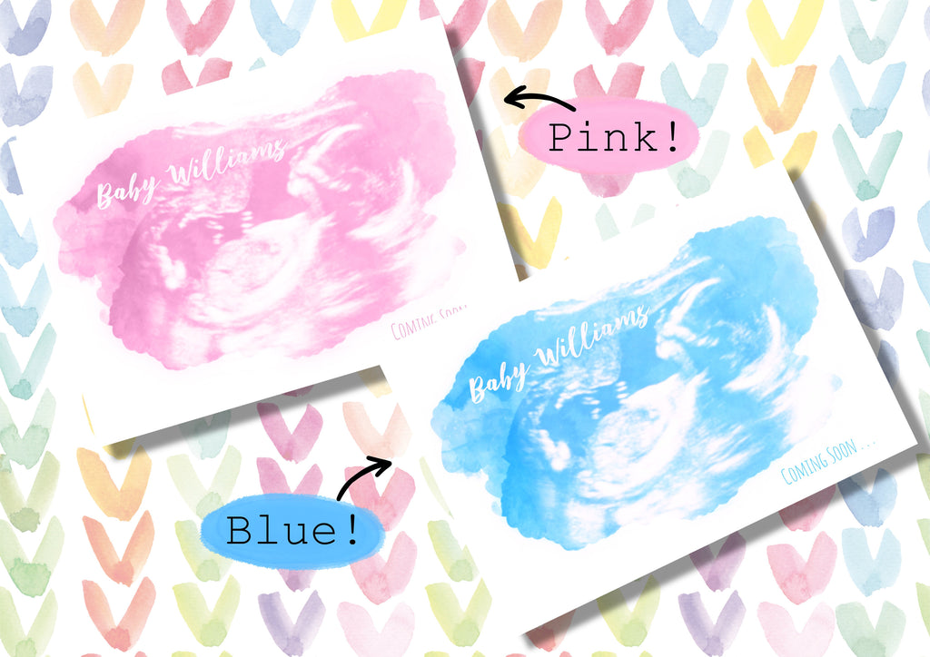 Watercolour Ultrasound or Sonogram Art, Baby scan print, card, Keepsake, digital available, Gender reveal Announcement, Mum to be, Pregnancy