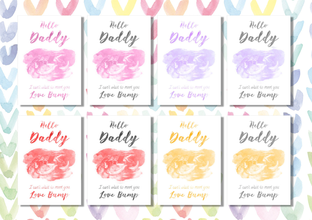Watercolour Ultrasound or Sonogram Art, Baby scan print, card, Keepsake, digital available, Gender reveal Announcement, Mum to be, Pregnancy